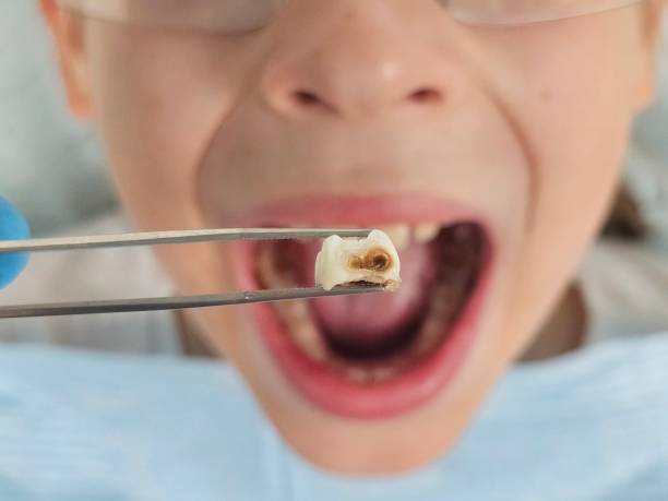 Best Emergency Broken Tooth Repair in Jericho, NY